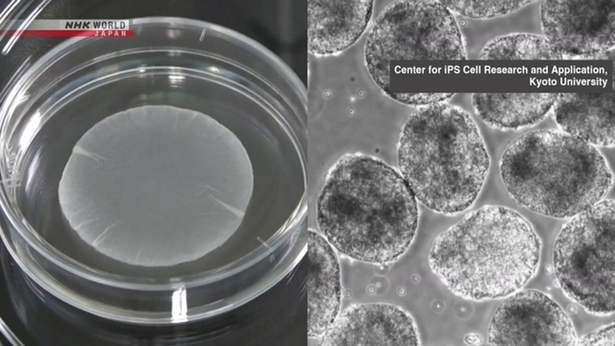 Panel Kemenkes Jepang Restui Dua Produk Medis Berbasis Sel iPS, Pertama di Dunia